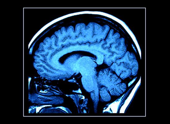 843e843d12a53636315037e31d5982f3 medium brain image